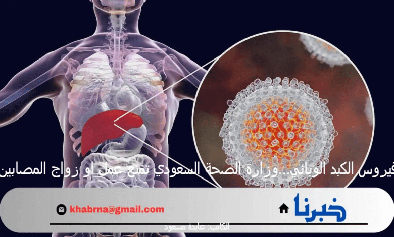 فيروس الكبد الوبائي…وزارة الصحة السعودي تمنع عمل او زواج المصابين