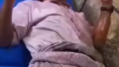 القبض على متهم بالاعتداء على مسن وحرقه بالزيت في إب
