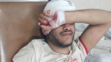 تعز.. إصابة شاب بجروح بالغة برصاص قناص حوثي