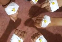عدن تغرق في موجة قاتلة من الحميات.. وغياب حكومي يزيد المأساة