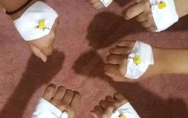 عدن تغرق في موجة قاتلة من الحميات.. وغياب حكومي يزيد المأساة