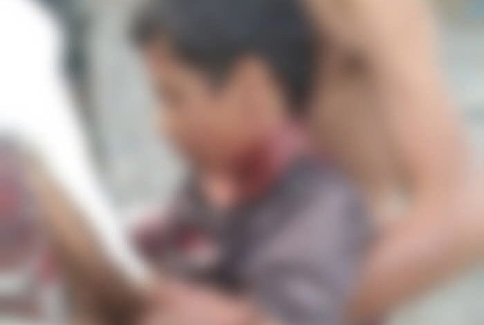 إصابة طفل برصاص قناصة مليشيا الحوثي شمال لحج