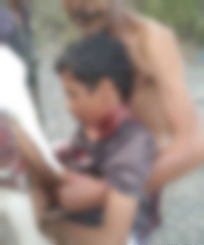 إصابة طفل برصاص قناصة مليشيا الحوثي شمال لحج