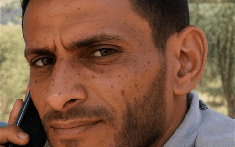 صنعاء.. العثور على جثة شخص مدفونًا في منطقة الروضة قرب الكلية الحربية
