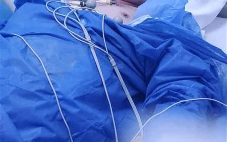 وكيل أول محافظة تعز يجري قسطرة قلبية ناجحة في مصر