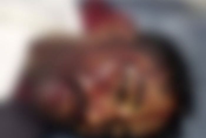 وفاة شخص وإصابة آخر نتيجة حادث مروري على الخط الرابط بين الخوخة والمخا