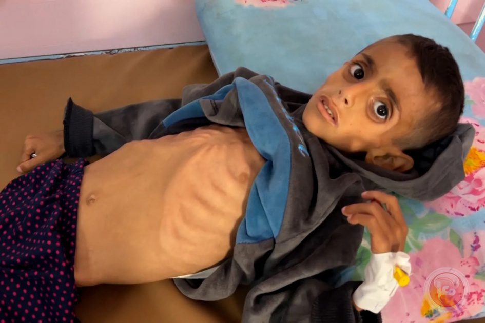 أكثر من 100 شخص ماتوا بسبب الجوع في غزة