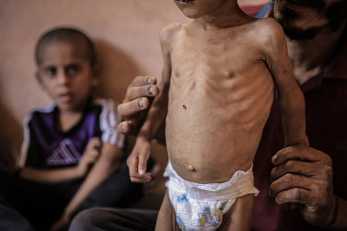 أكثر من مليون طفل يعانون من الجوع بغزة