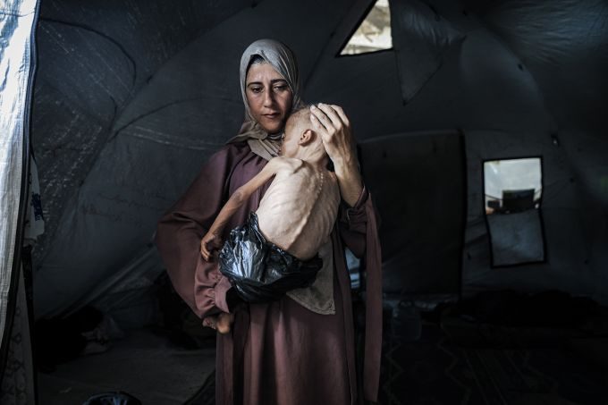 حين يصبح الأمل طعاما وحيدا.. غزة تدفع ثمن صمت الضمير العالمي