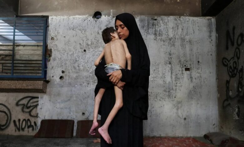 المجاعة تتفشى في غزة.. فما الذي يمنع إعلانها رسميا؟