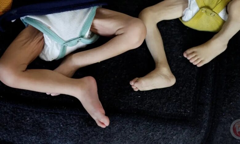 أطفال غزة يموتون جوعاً.. اليونيسف تدعو لإنقاذ جيل بأكمله من الهلاك