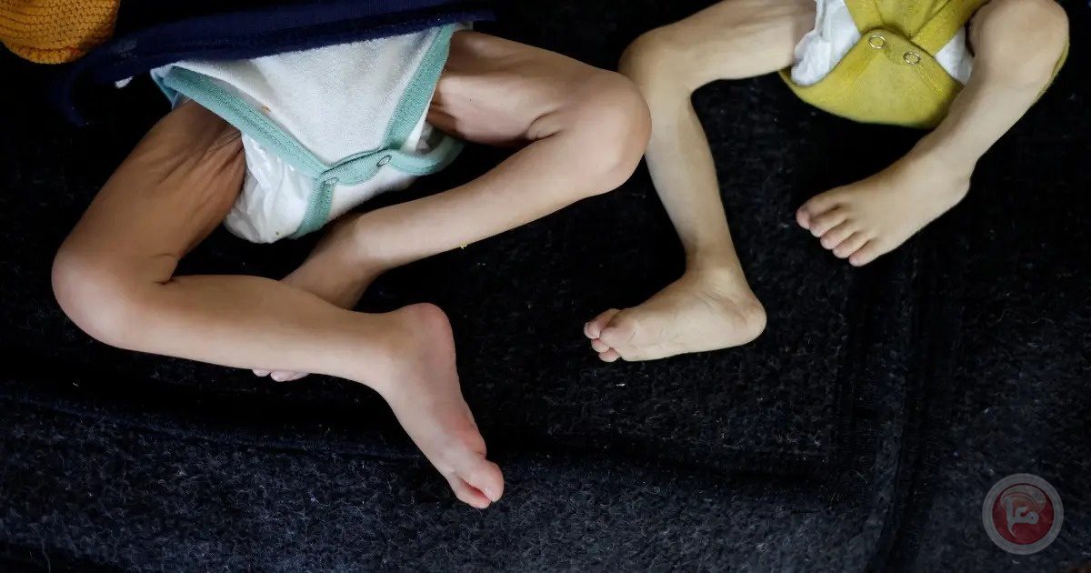 أطفال غزة يموتون جوعاً.. اليونيسف تدعو لإنقاذ جيل بأكمله من الهلاك