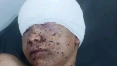إصابة طفل بشظية قذيفة أطلقتها مليشيا الحوثي شمالي مدينة تعز