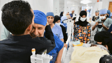 بعد عملية معقدة لـ8 ساعات.. نجاح فصل التوأم الملتصق السوري "سيلين وإيلين"