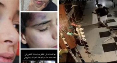 "اعتداء صادم لطفل في قلب صنعاء.. وحشية حوثية تثير غضب اليمنيين"