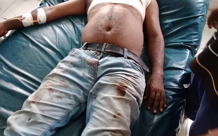 هجوم مسلح يستهدف حافلة موظفين شركة أسمنت الوحدة في أبين ويُصيب شخصين