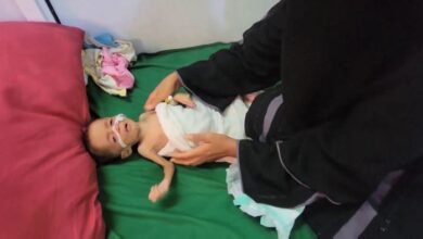شبح الأوبئة ينهش أطفال اليمن.. والحوثيون يغلقون أبواب الوقاية
