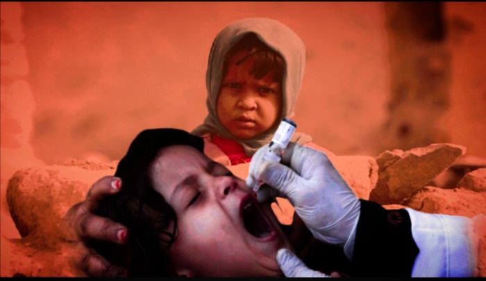 شلل الأطفال.. كابوس الطفولة في اليمن الذي أحياه الحوثيون من العدم