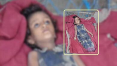 صحفي استقصائي يفضح محاولة حوثية لتزييف وفاة الطفلة أشواق جوعًا