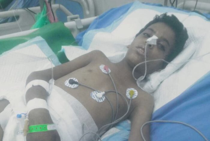 لحج.. استشهاد طفل متأثرًا بإصابته برصاص قناص حوثي