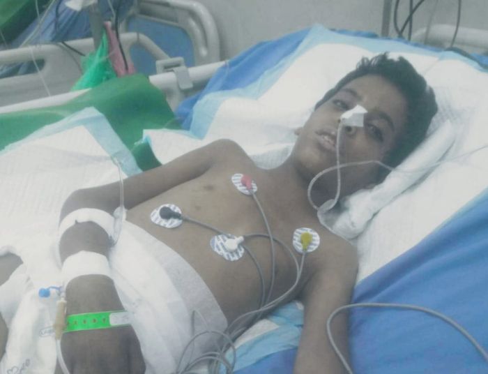 لحج.. استشهاد طفل متأثرًا بإصابته برصاص قناص حوثي