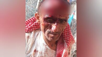 مليشيا الحوثي تعتدي بوحشية على طبيب أمام أسرته في إب
