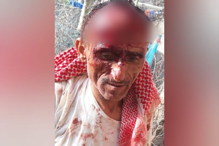 مليشيا الحوثي تعتدي بوحشية على طبيب أمام أسرته في إب