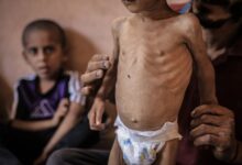 منظمة العفو الدولية تتهم إسرائيل بسياسة تجويع متعمدة في غزة