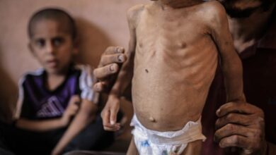منظمة العفو الدولية تتهم إسرائيل بسياسة تجويع متعمدة في غزة