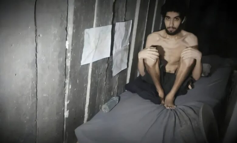 "يأكلون مما نأكل".. أسير إسرائيلي بجسد هزيل والصحافة الاسرائيلية "يا للعار"