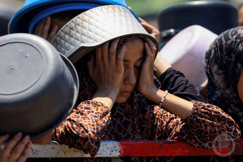 6 وفيات نتيجة المجاعة وسوء التغذية خلال 24 ساعة