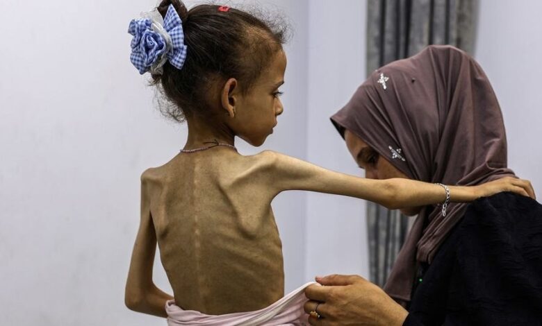 500 رضيع في مستشفيات غزة بسبب الجوع