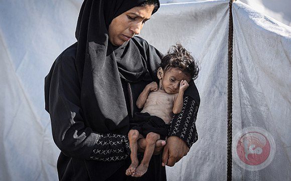 الوضع كارثي.. قطاع غزة دخل مرحلة حرجة من المجاعة