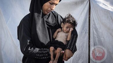تسجيل 5 حالات وفاة جديدة نتيجة سوء التغذية في قطاع غزة