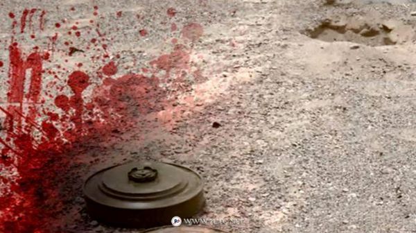 إصابة شاب ووالده بانفجار لغم حوثي جنوبي الحديدة