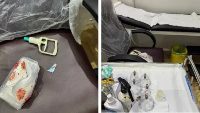 ضبط مقيمة تمارس الحجامة دون ترخيص في حفر الباطن
