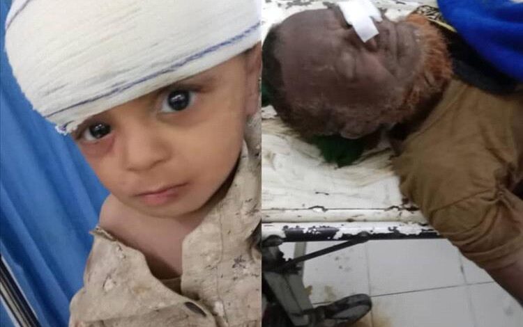 مدير عام مودية يناشد محافظ أبين للتدخل ومساعدة أسرة متضررة من الأمطار