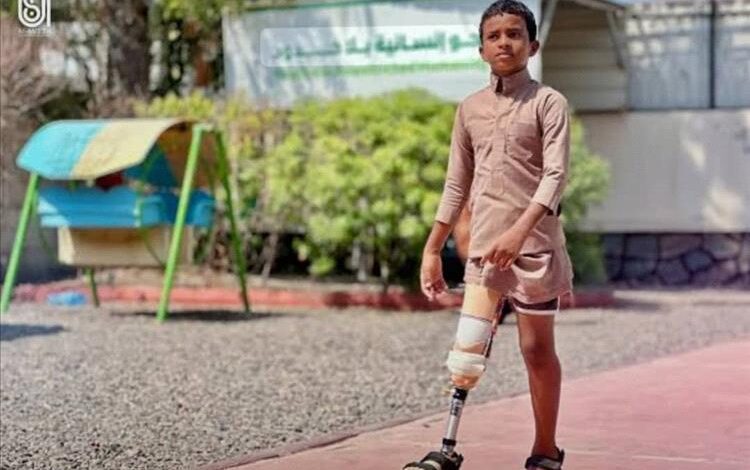 مركز الأطراف الصناعية بعدن يقدّم خدماته لـ595 مستفيداً خلال يوليو 2025م