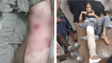 تعز: إصابة شاب وطفل برصاص قناص حوثي أثناء تعبئة المياه