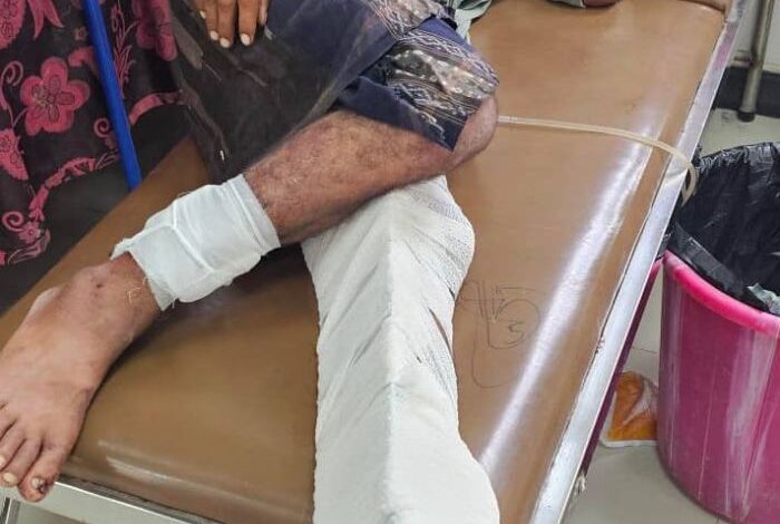 تعز.. إصابة مدني برصاص قناص حوثي في مقبنة