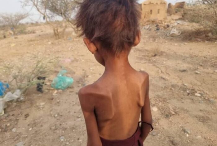 صندوق الأمم المتحدة للسكان يحذر: 41 ألف شخص في عبس يواجهون خطر المجاعة