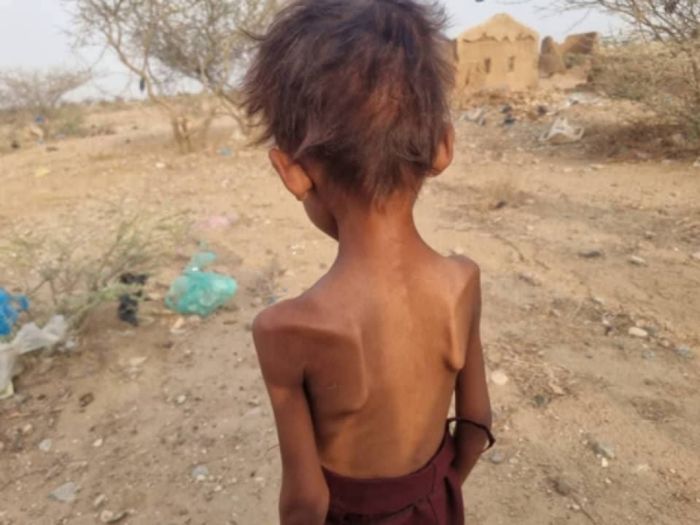 صندوق الأمم المتحدة للسكان يحذر: 41 ألف شخص في عبس يواجهون خطر المجاعة