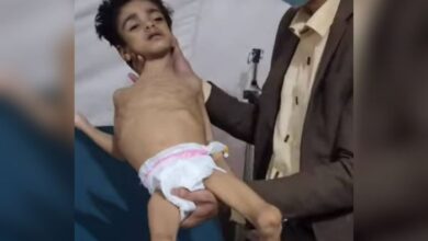 طفل يواجه الموت جوعًا في حجة.. مشهد جديد يلخص الكارثة الإنسانية التي صنعتها مليشيا الحوثي