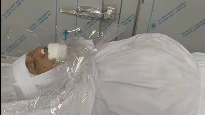 قناص حوثي يقتل مواطنًا شمال شرق تعز