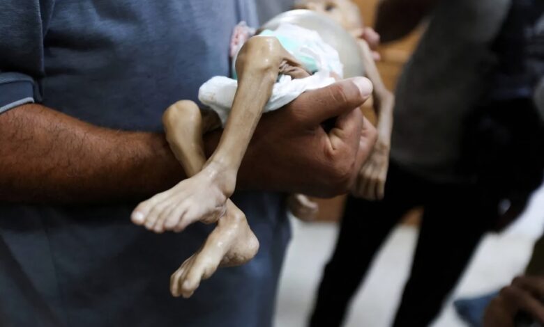 وفاة طفلة في مدينة غزة نتيجة المجاعة