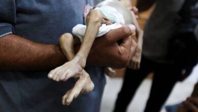 من بينهم 3 أطفال- 5 حالات وفاة نتيجة المجاعة خلال يوم في قطاع غزة