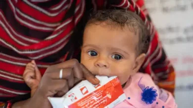 «يونيسف»: سوء التغذية الحاد تجاوز الطوارئ في 60% من مناطق السودان