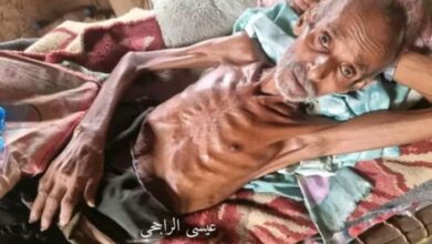 الجوع يواصل الفتك بالنازحين في حجة