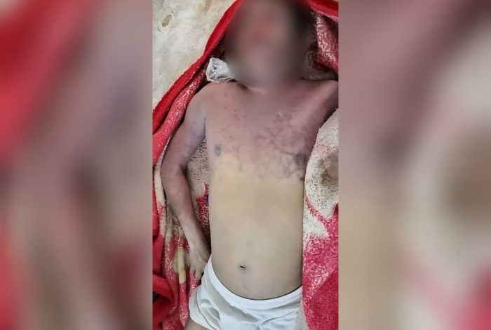 عمران.. وفاة بائع آيس كريم تحت التعذيب في سجون مليشيا الحوثي