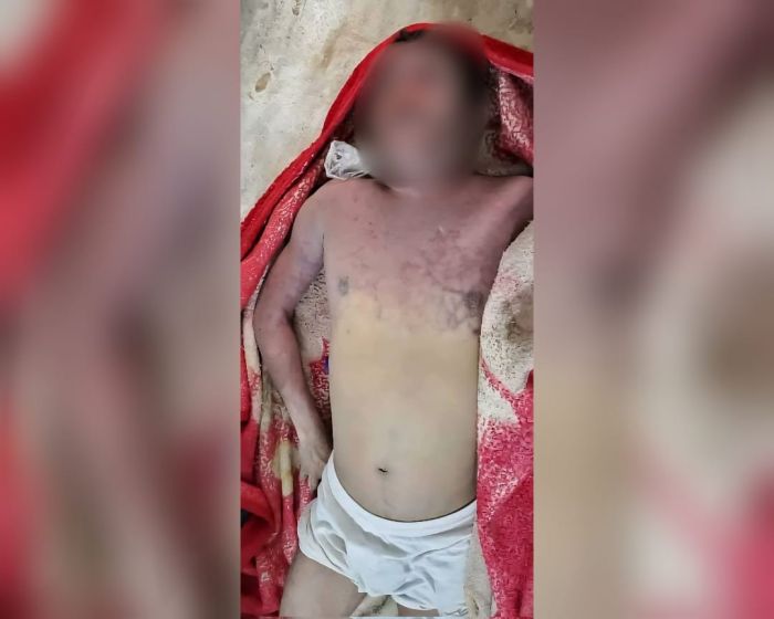 عمران.. وفاة بائع آيس كريم تحت التعذيب في سجون مليشيا الحوثي